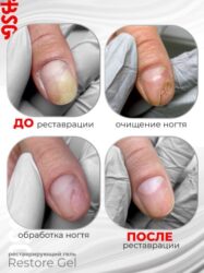 Restore Gel — гипоаллергенный гель для реставрации и протезирования (5 мл)